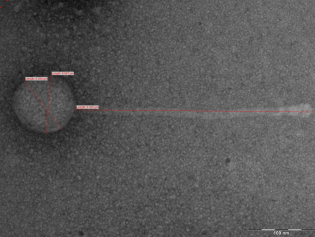One of the phages I discovered through EM; note that this one is straight, and its dimensions could easily be measured.